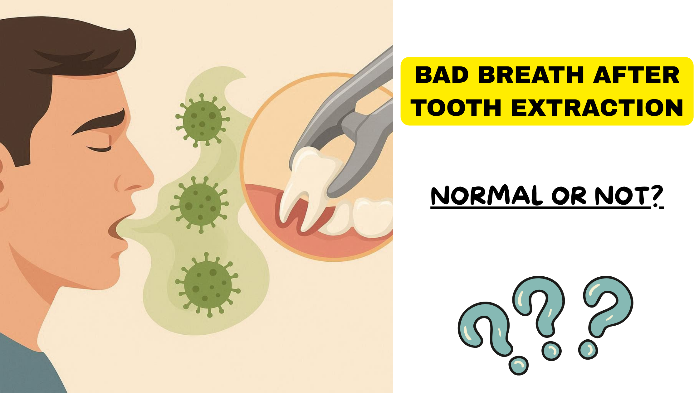Bad breath after wisdom tooth removal