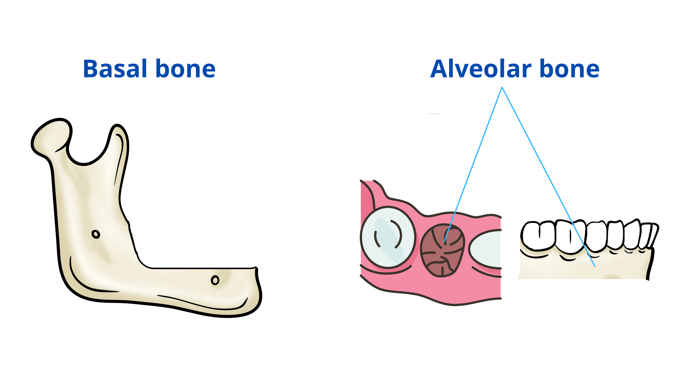 the difference between the basal bone and alveolar bone