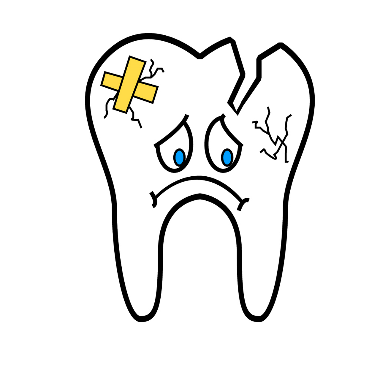 Broken tooth