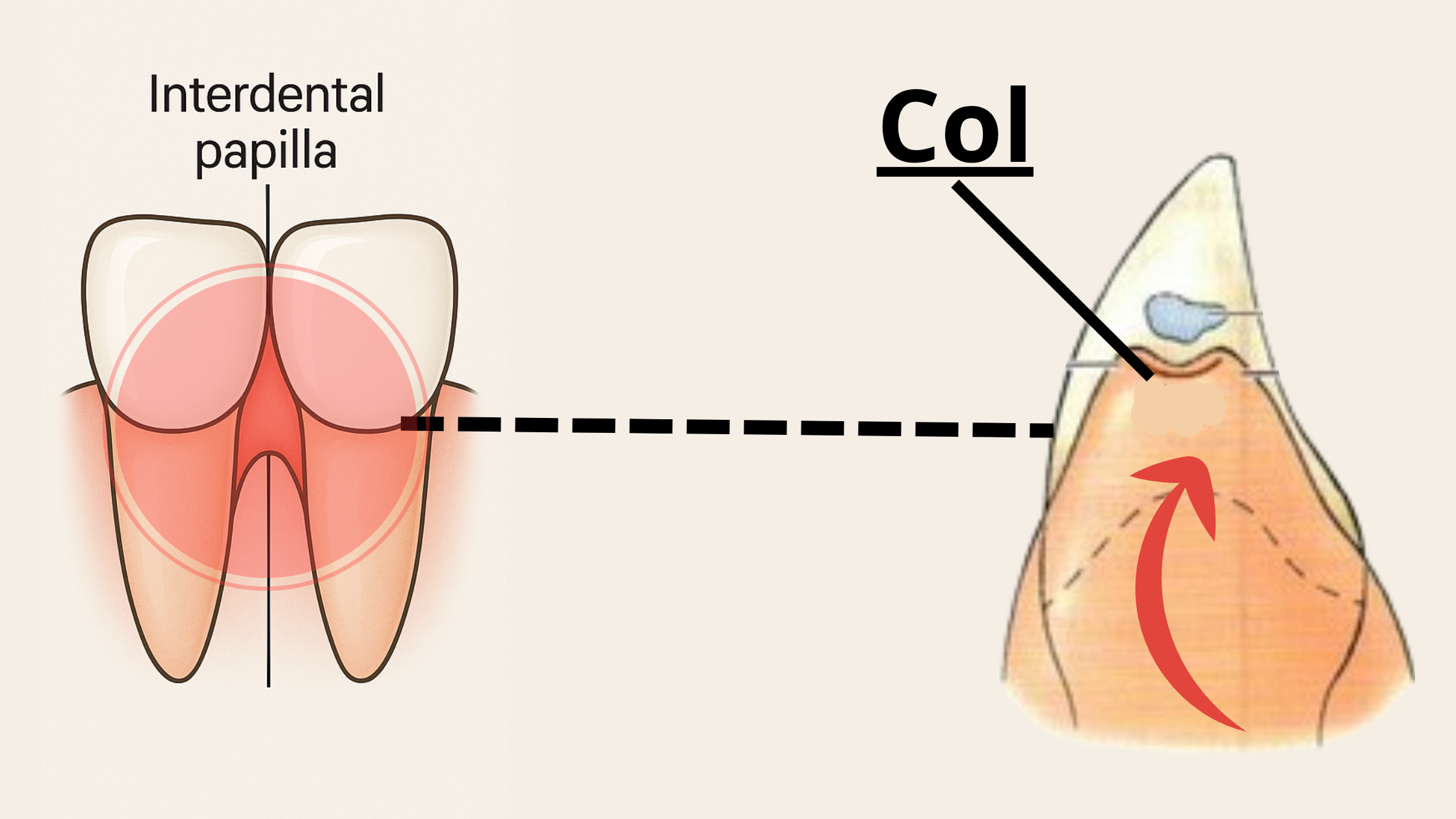 The col and interdental papilla anatomy