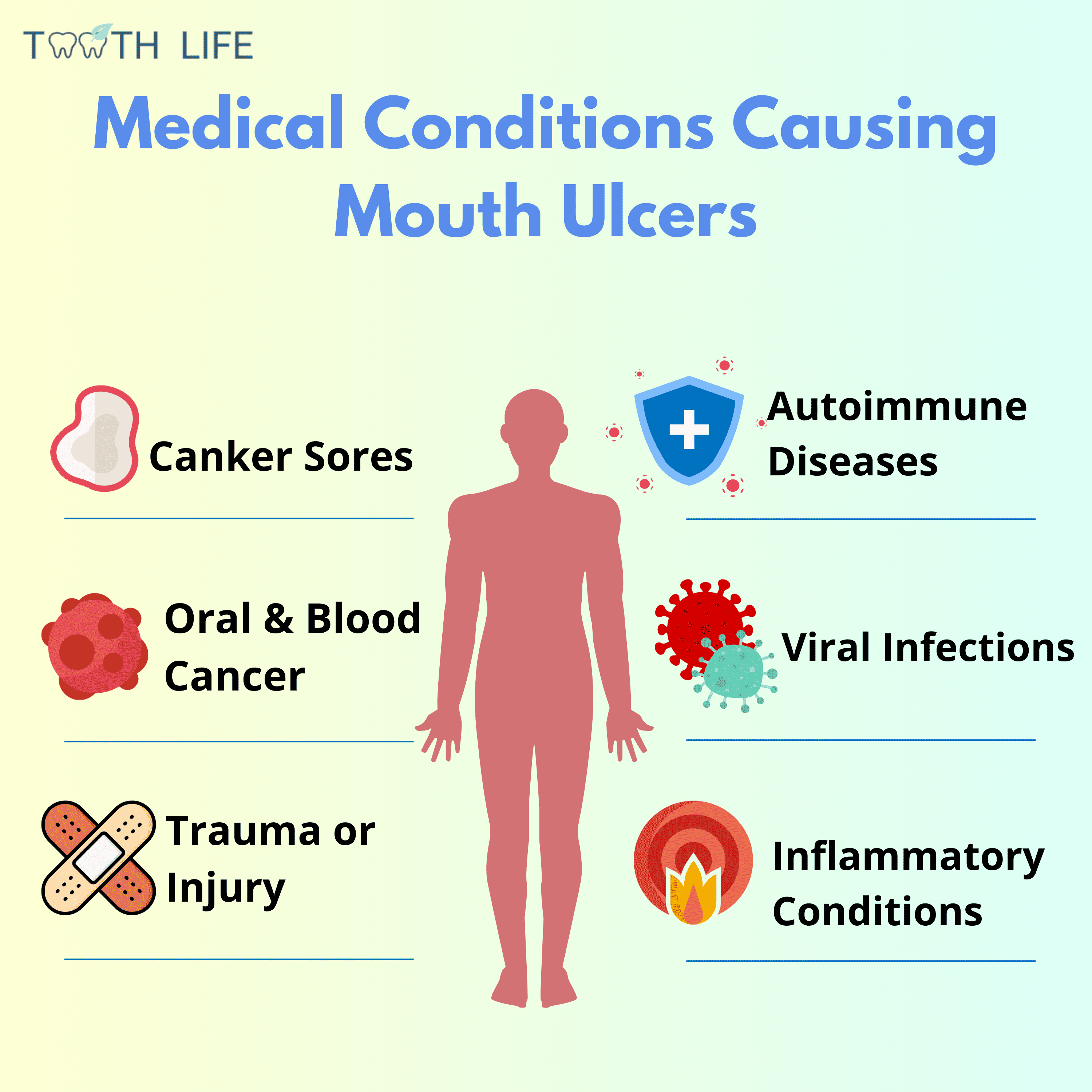 Conditions that can lead to mouth ulcers