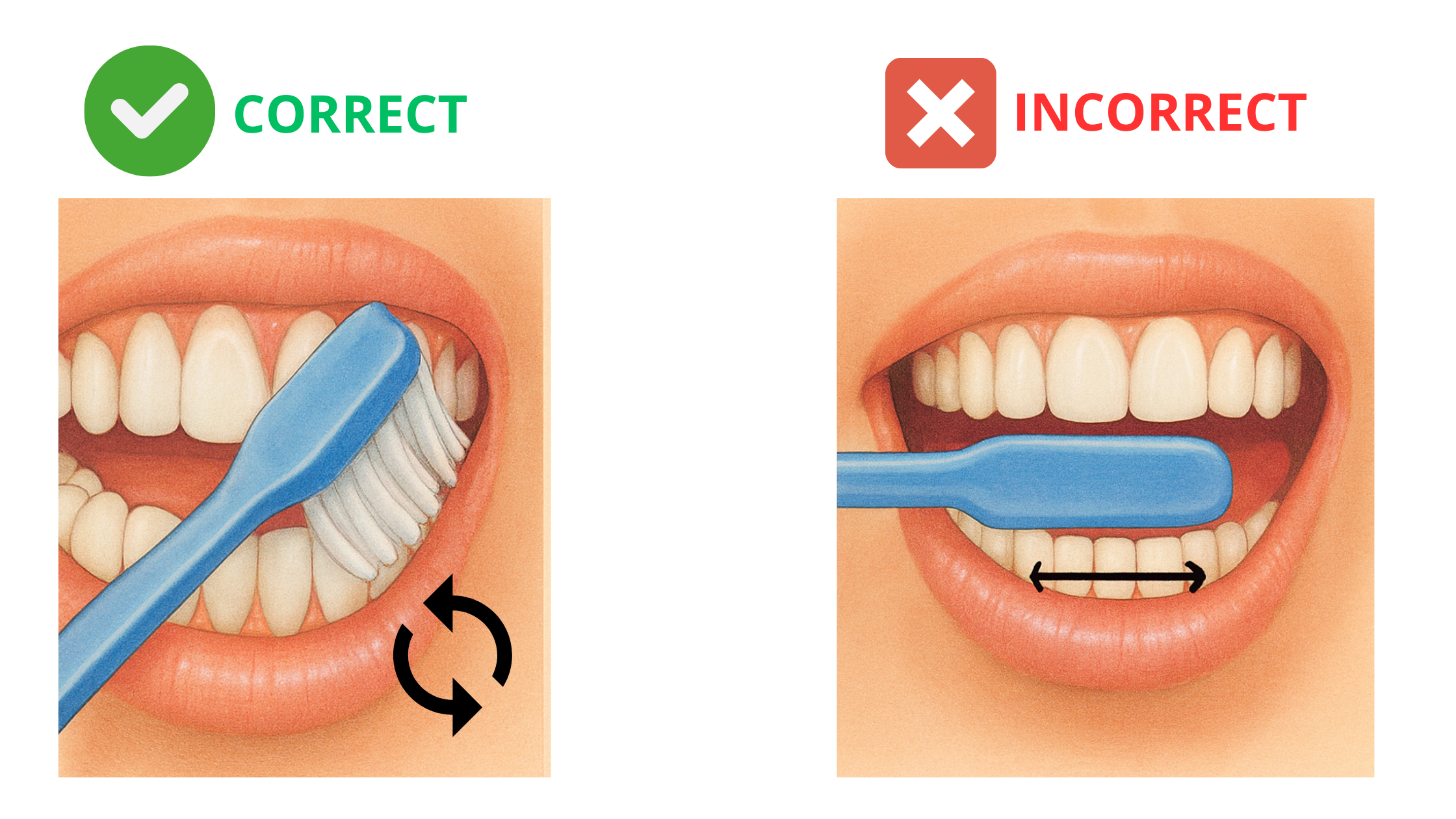Correct brushing technique vs. incorrect technique