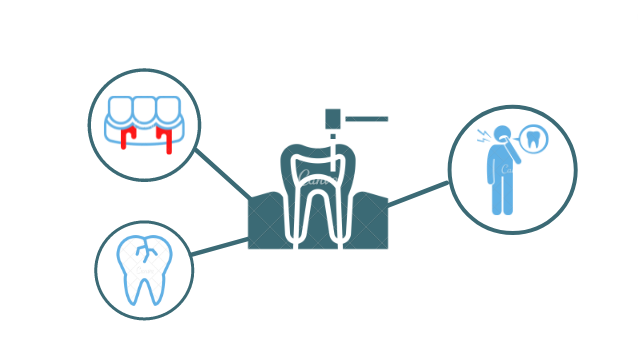 cracked teeth