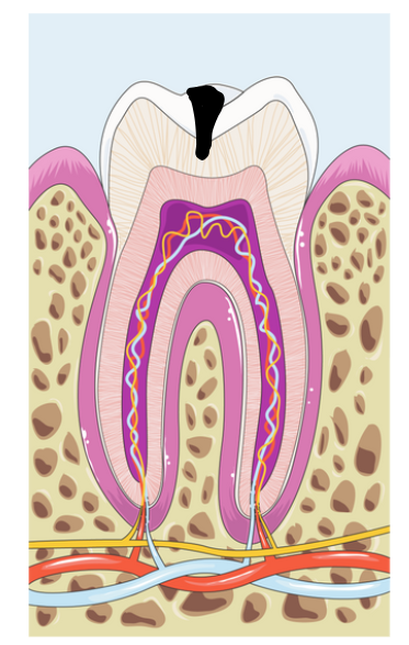 dentin stage