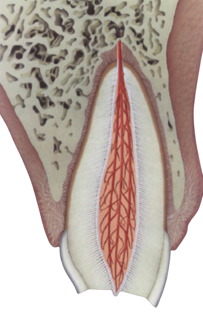 Enamel-Dentin-Pulp horizontal fracture