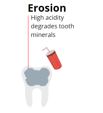 tooth erosion