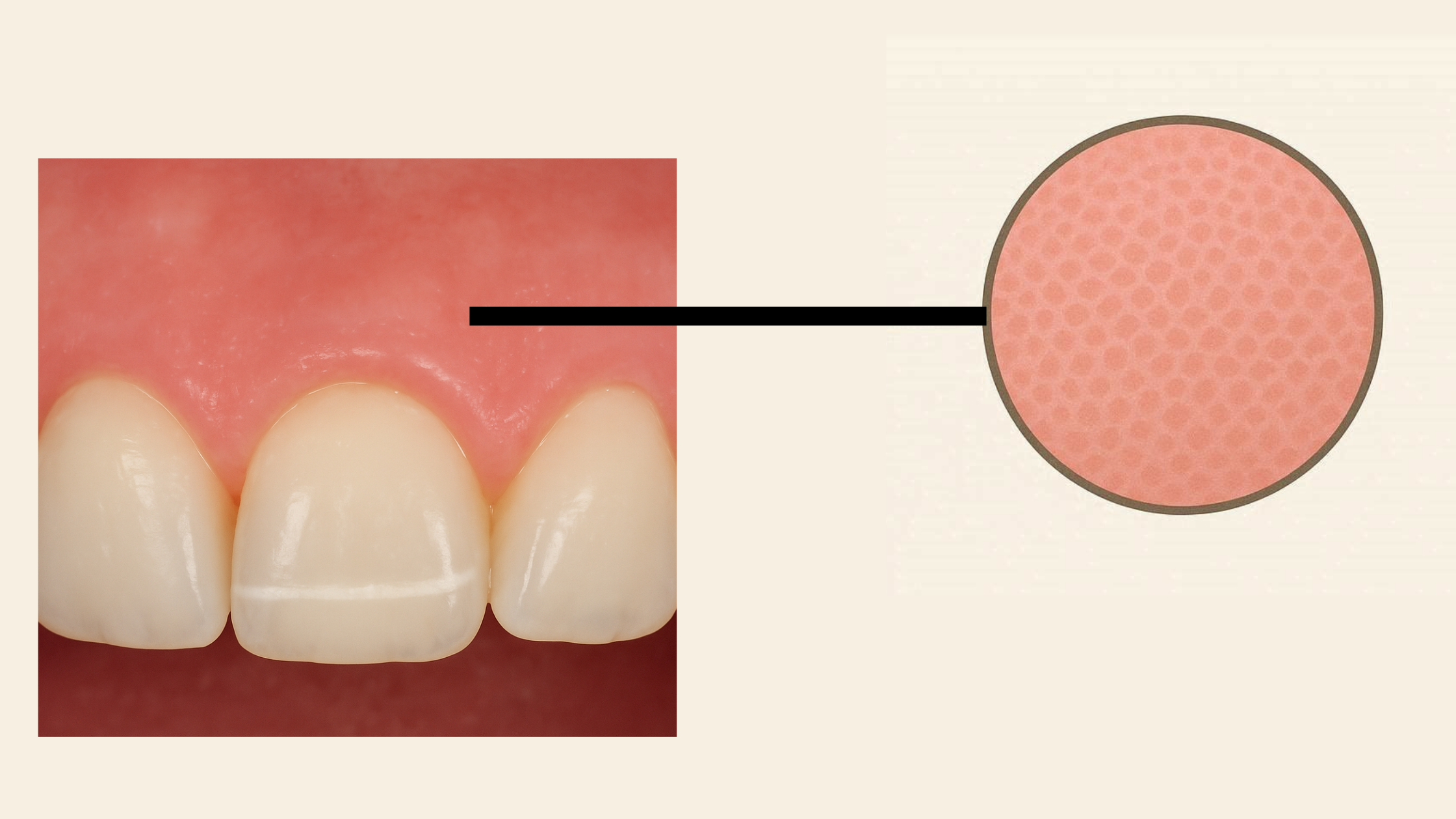 Healthy gums have a textured surface, like an orange peel