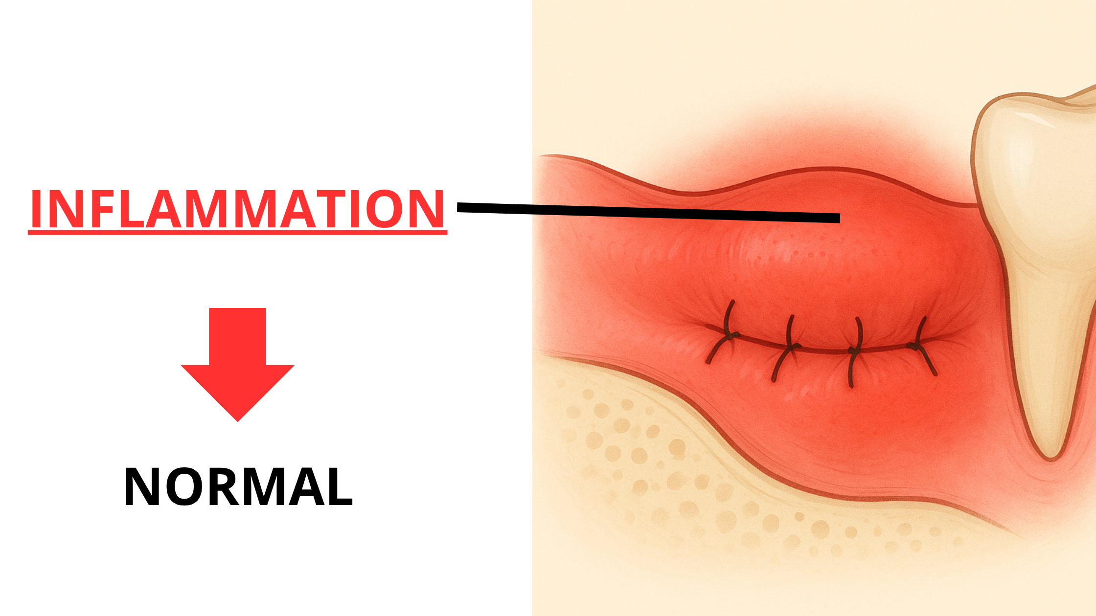 Inflammation after dental surgery: A normal reaction
