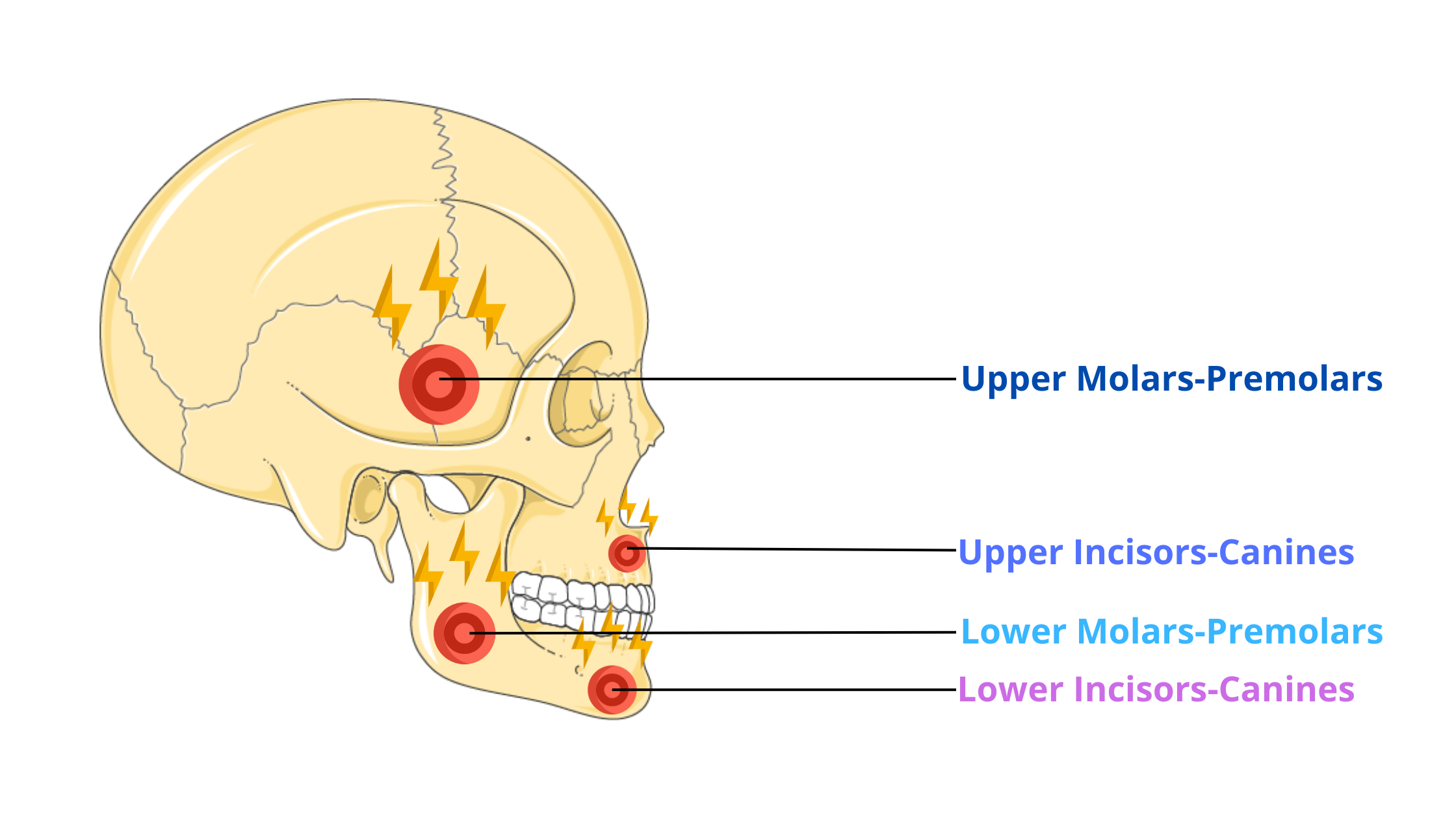 The location of jaw pain according to the type of infected tooth