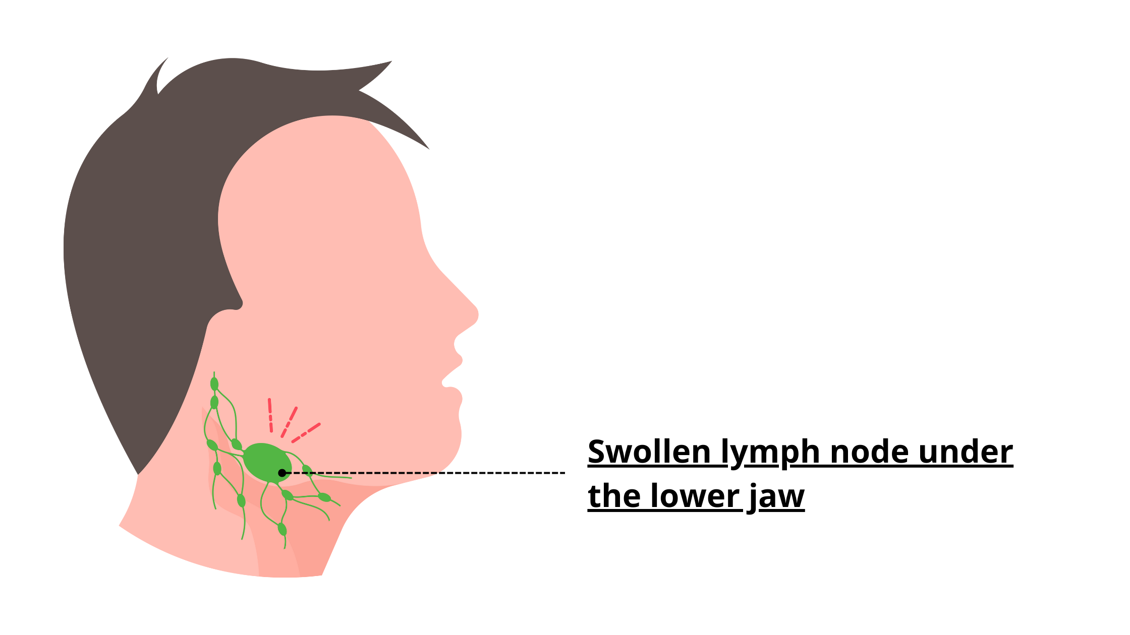 Lymph nodes of the lower jaw