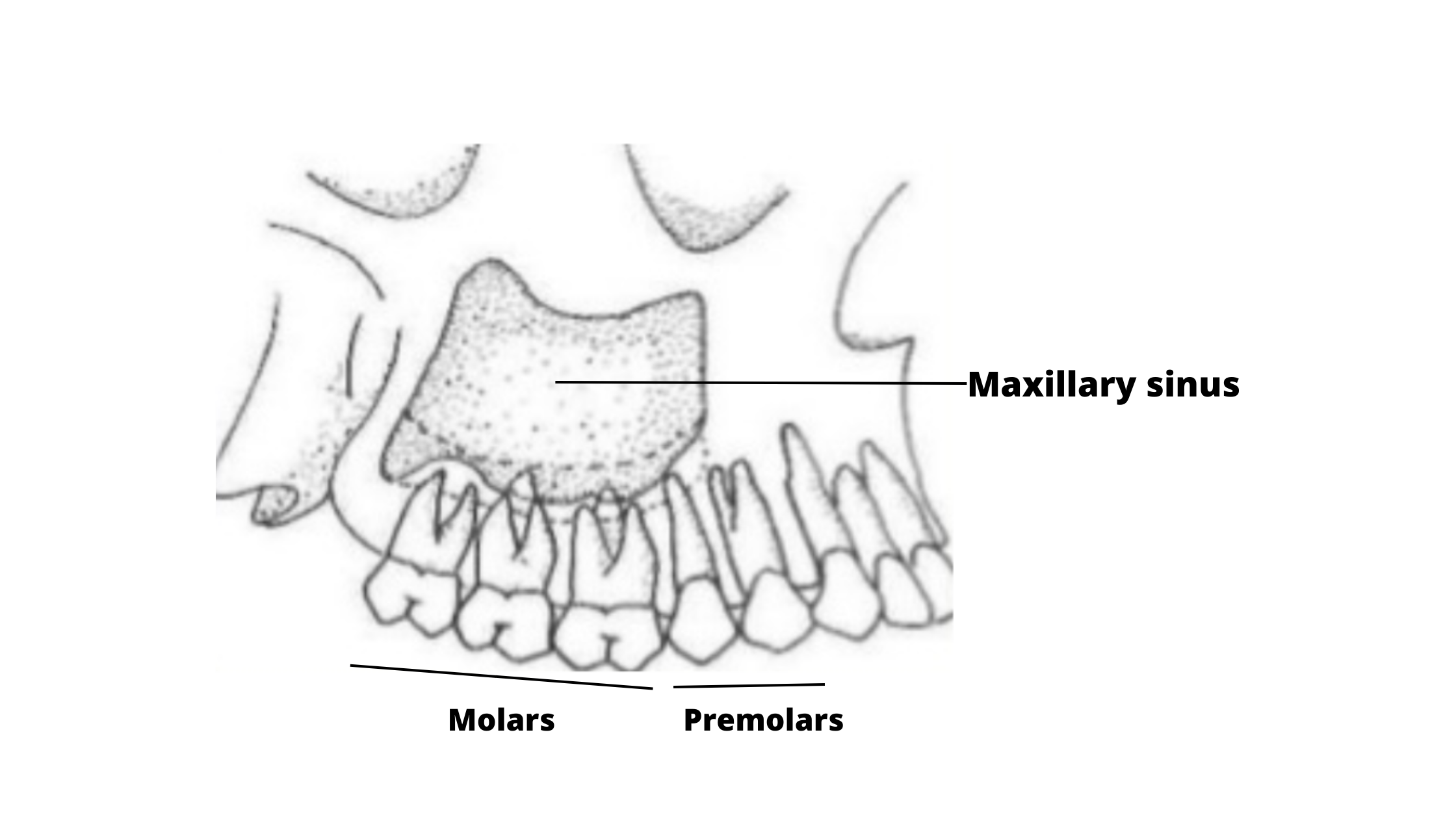 maxillary sinus