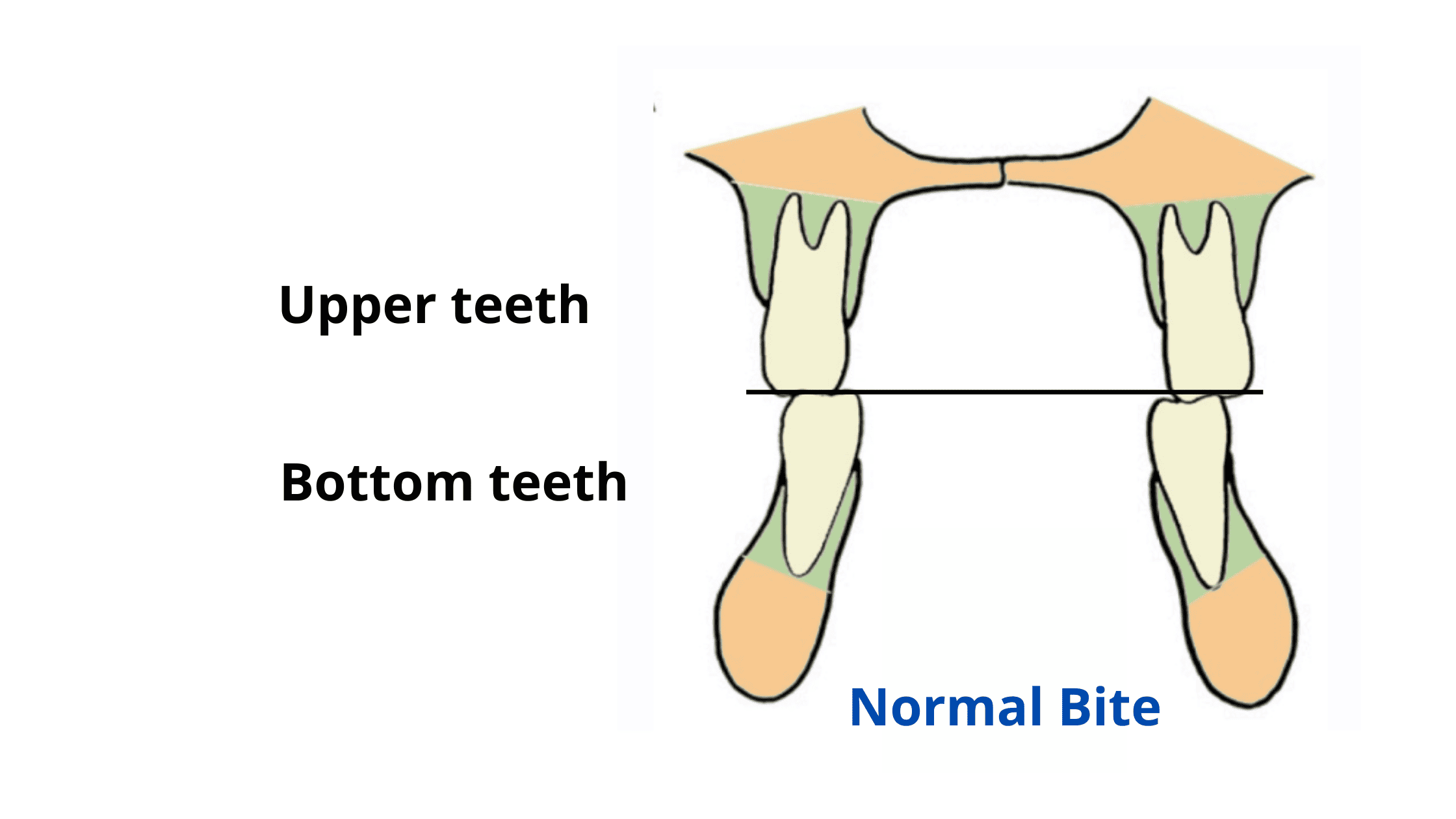 normal bite