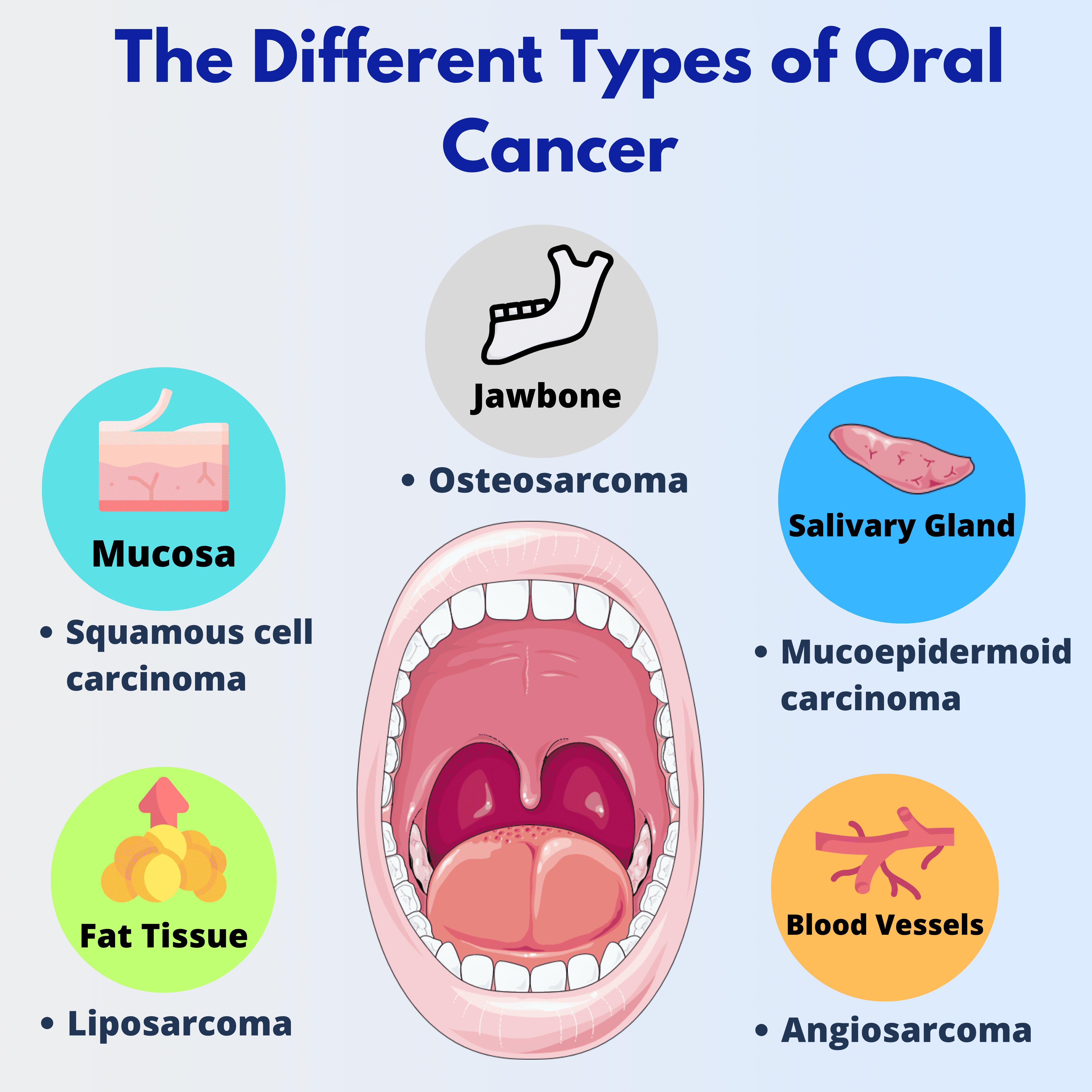 The different types of oral cancer depending on the tissue from which it originates