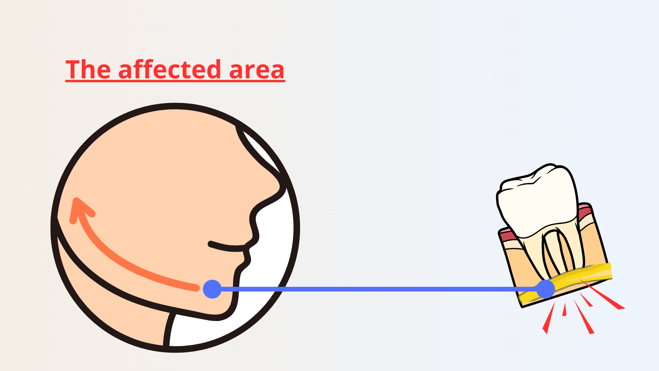 the area affected by the tingling sensation due to an inferior alveolar nerve injury
