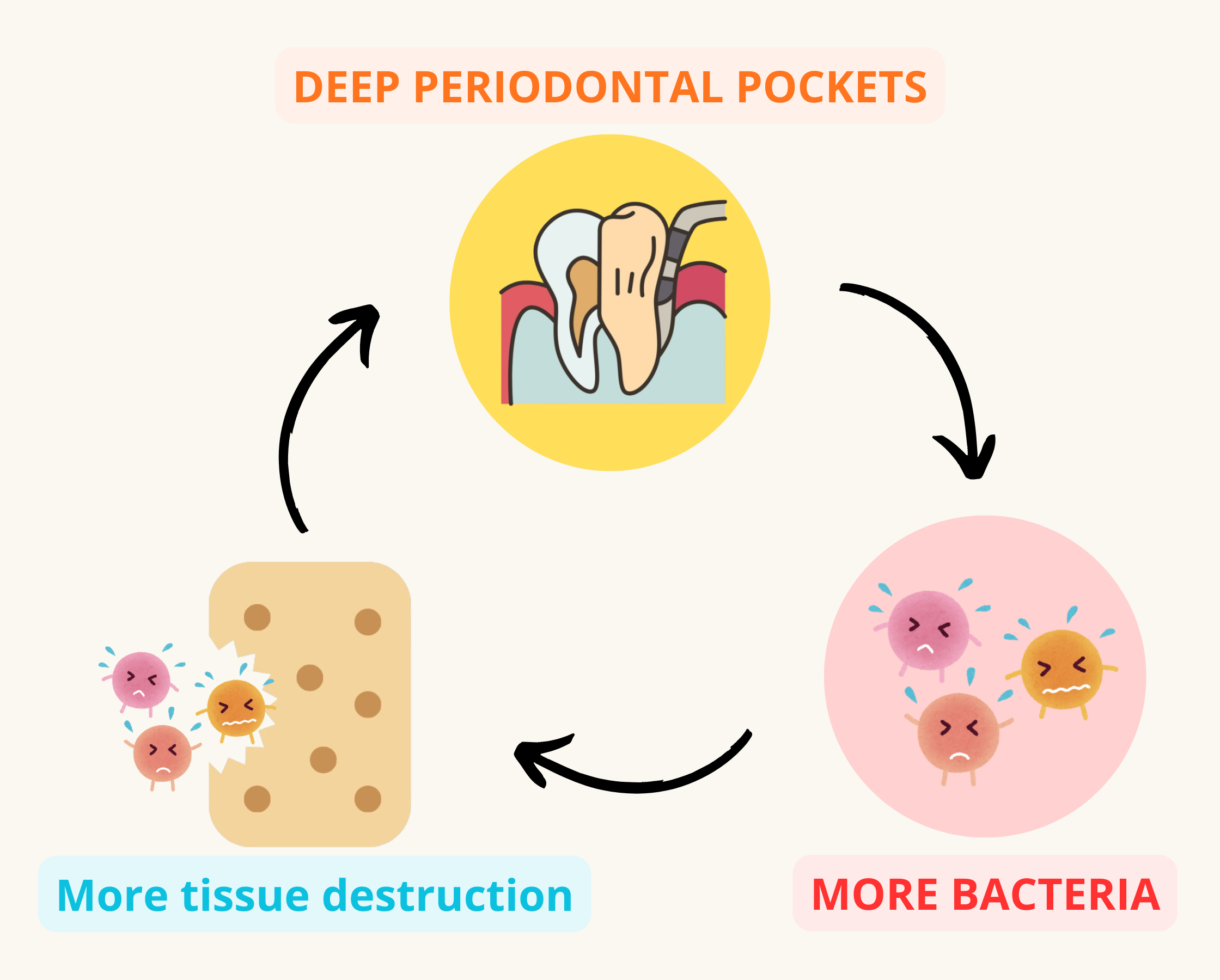 Periodontal pockets sustaining a vicious cycle
