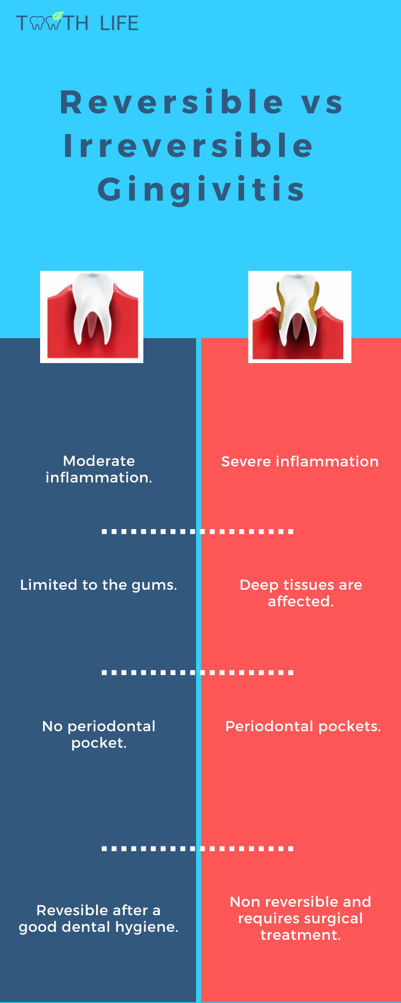 reversible vs irreversible gingivitis