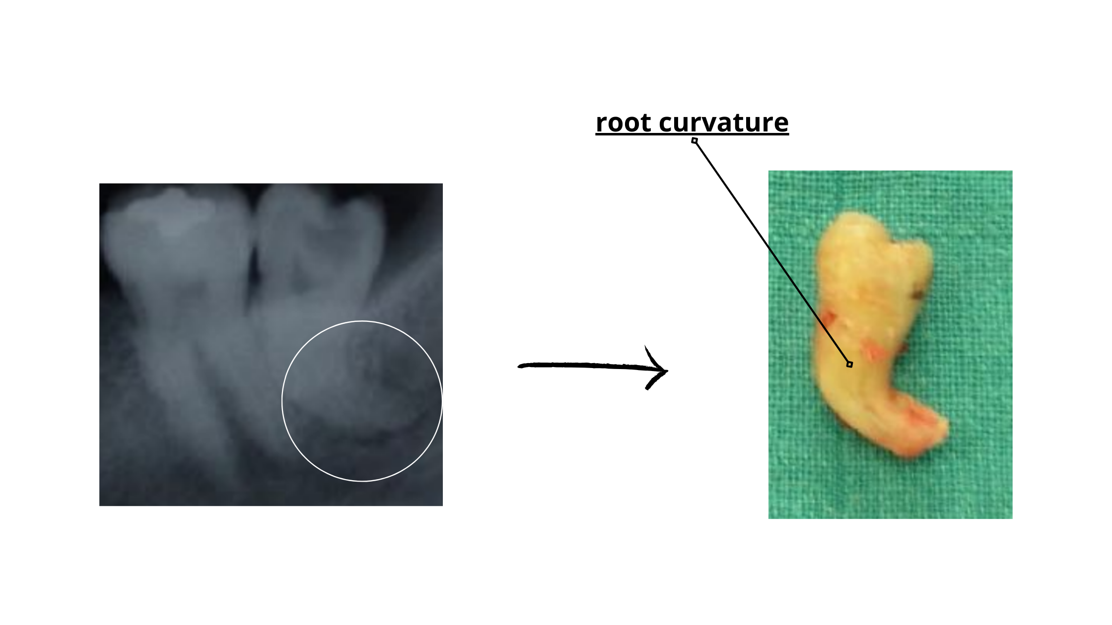 Curved root shape