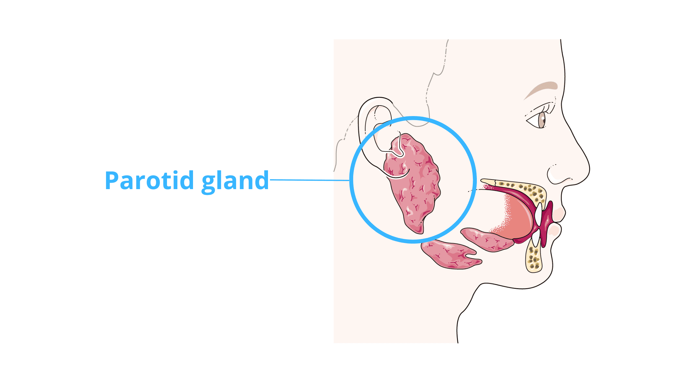 salivary gland tumors