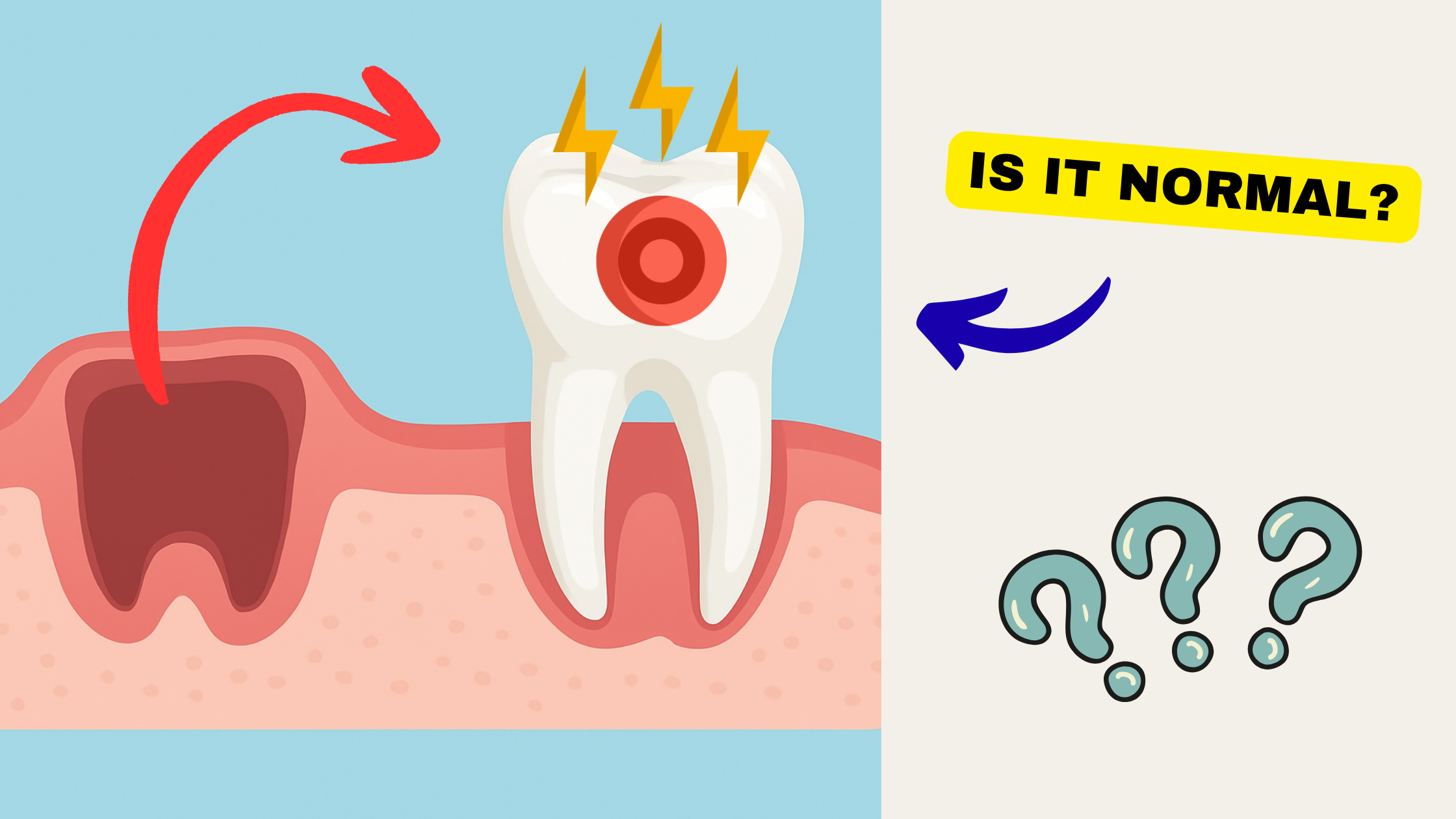 Surrounding teeth hurt after tooth extraction