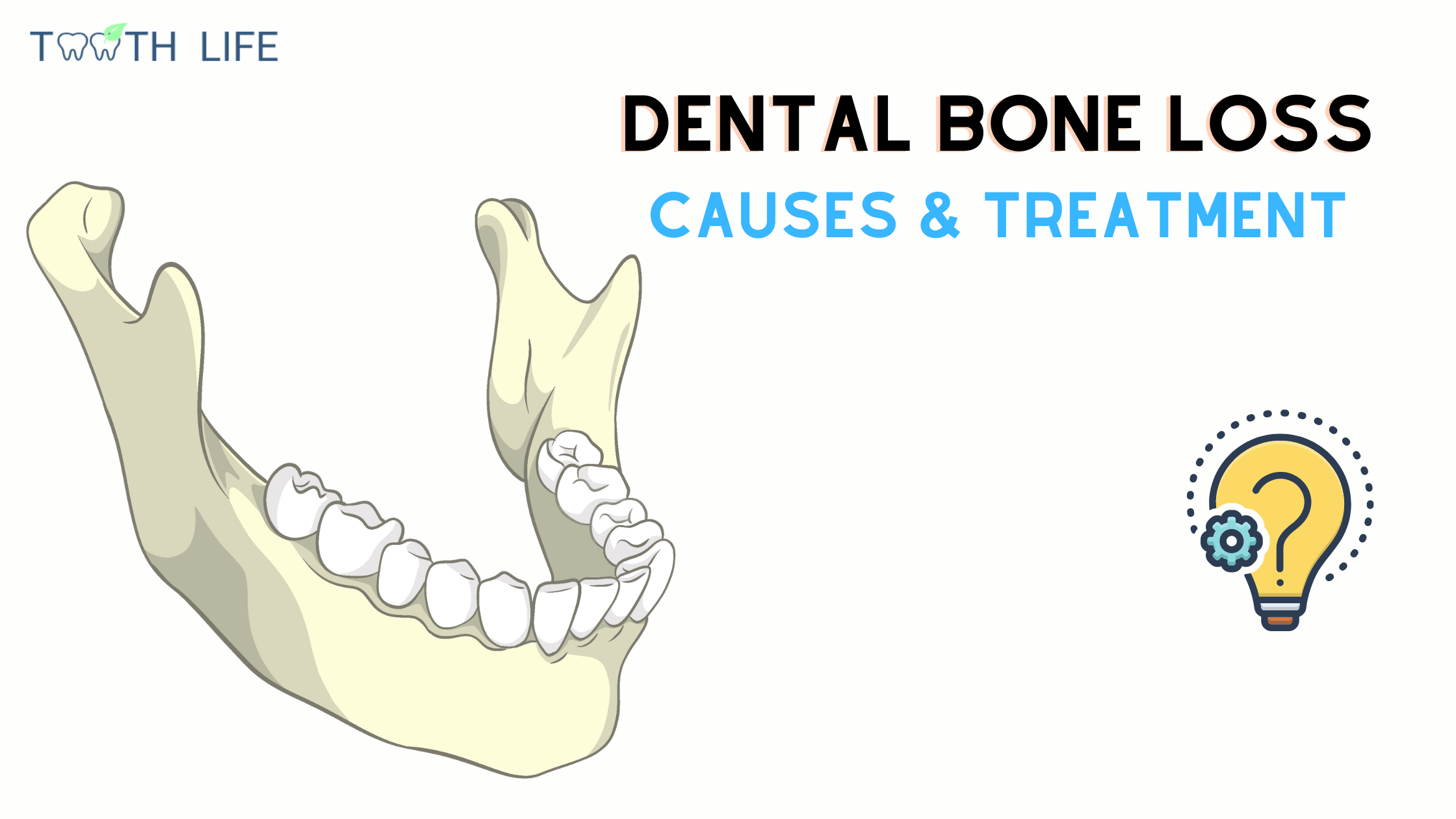 bone loss in teeth