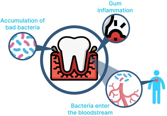 the link between dental health and heart