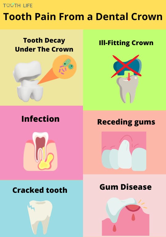 the causes of tooth pain from a dental crown