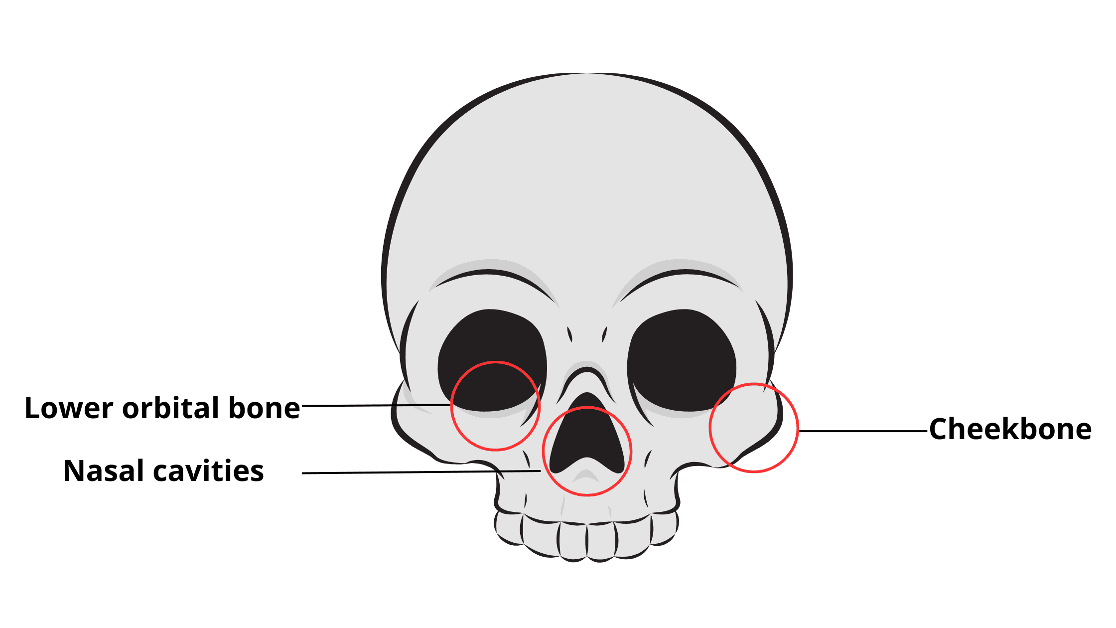 The upper jaw (maxilla) and its relationship to other facial structures