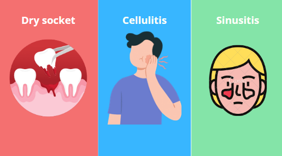 complications of wisdom teeth after removal